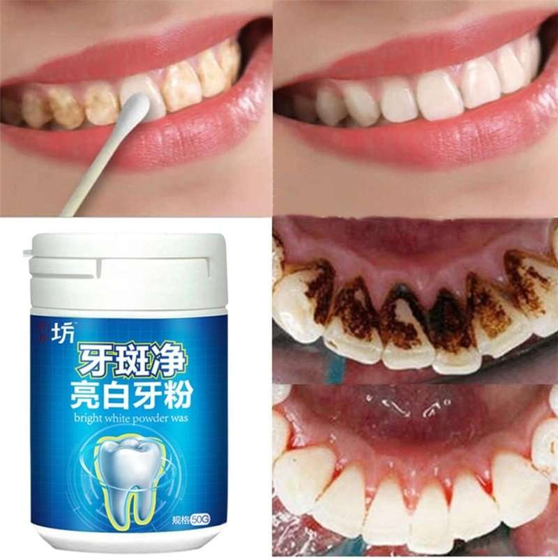50G Toothpaste Whitening blanqueador dental coffee stain ...